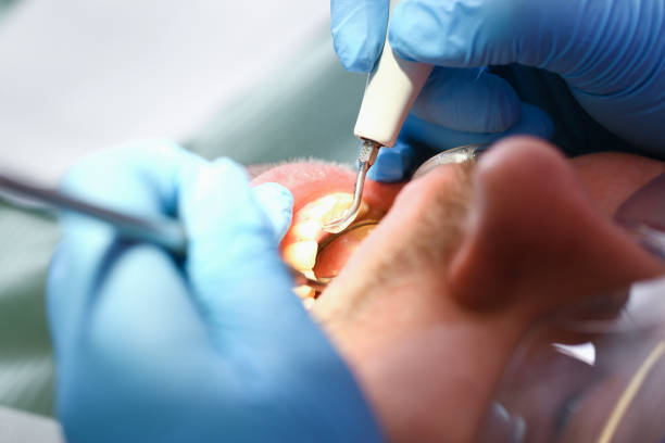 Best Emergency Tooth Extraction  in Holstein, IA