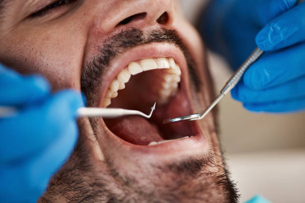 Best Emergency Tooth Extraction  in Holstein, IA