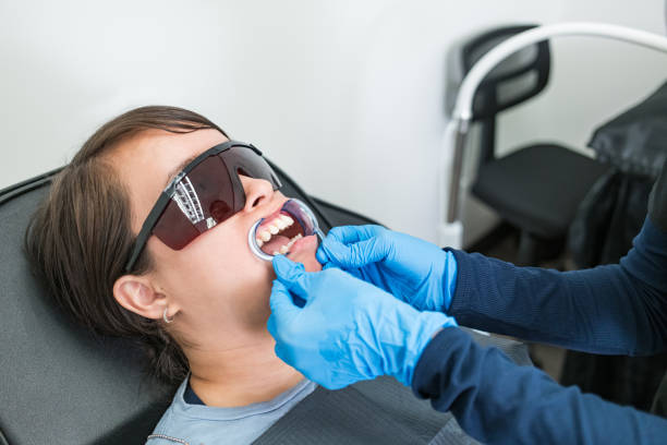 Teeth Whitening in IA